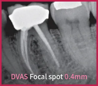 Dental X Ray Model : DEVAS