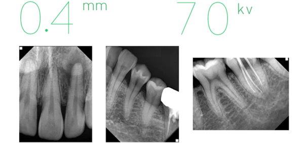 All-In-One Portable X-ray System Model: Port-X-IV