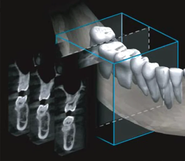 Dental OPG 2-In-1 Dental X-ray Imaging system Model : Papaya Plus