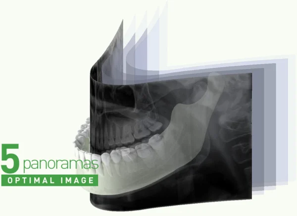 Dental OPG 2-In-1 Dental X-ray Imaging system Model : Papaya Plus