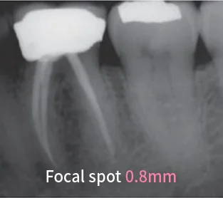 Dental X Ray Model : DEVAS