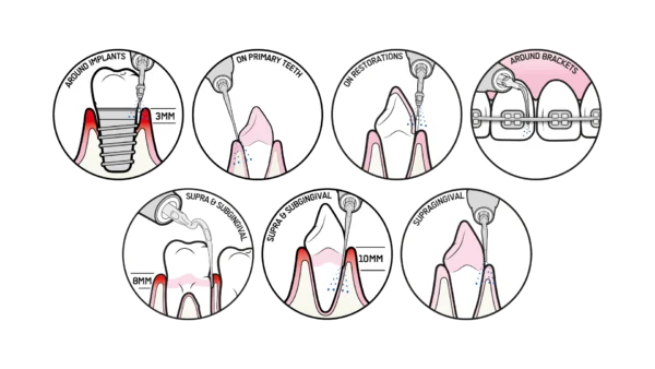 EMS Piezon 250 Including LED Handpiece Model : 250 LED ISO/CE/FDA Approved (EMS-SWISS)