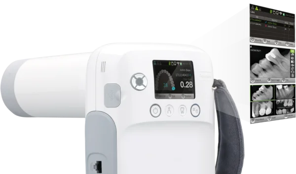 All-In-One Portable X-ray System Model: Port-X-IV
