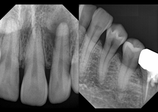 Extraordinary Intraoral Sensor Model : PortView - Image 2
