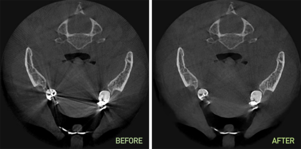 CBCT 4-In-1 Dental X-ray Imaging system PAPAYA 3D PLUS - Image 9