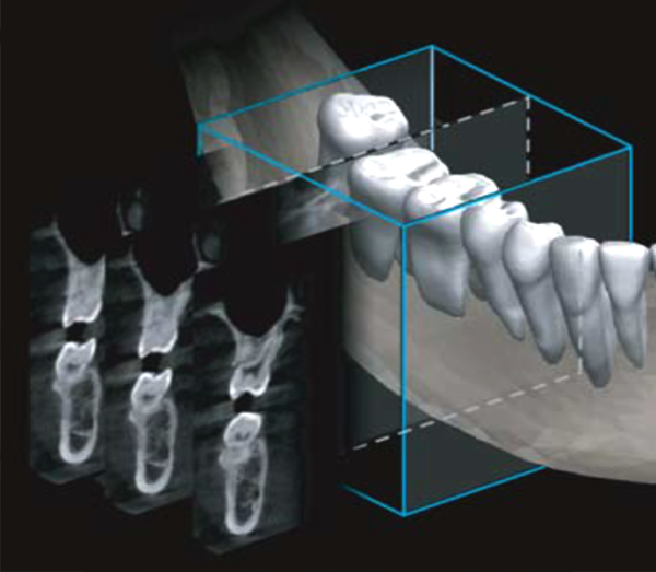 Dental OPG 2-In-1 Dental X-ray Imaging system Model : Papaya Plus - Image 5