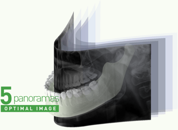 Dental OPG 2-In-1 Dental X-ray Imaging system Model : Papaya Plus - Image 3