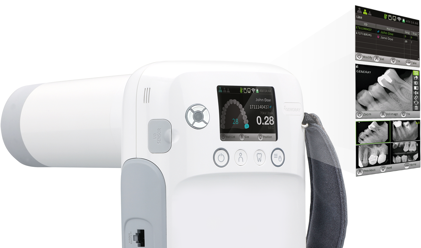 All-In-One Portable X-ray System Model: Port-X-IV - Image 2