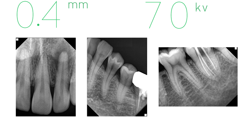 All-In-One Portable X-ray System Model: Port-X-IV - Image 6